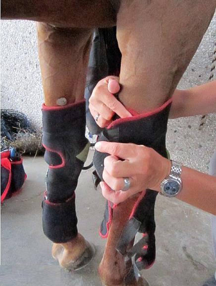Anlegen der Narkolepsiebandage